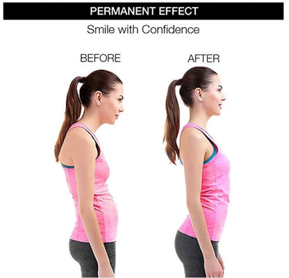 Adjustable Posture Corrector